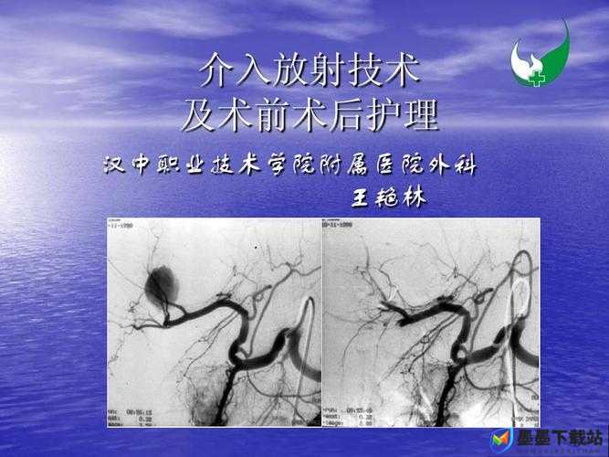 双点医院放射遗传技能究竟有何神奇作用与效果？详解来了！